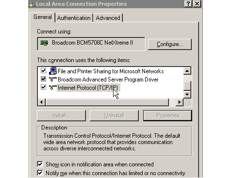 sap_r3_erp_upgrade_7 Important: automatic TCP/IP settings for the IP und DNS